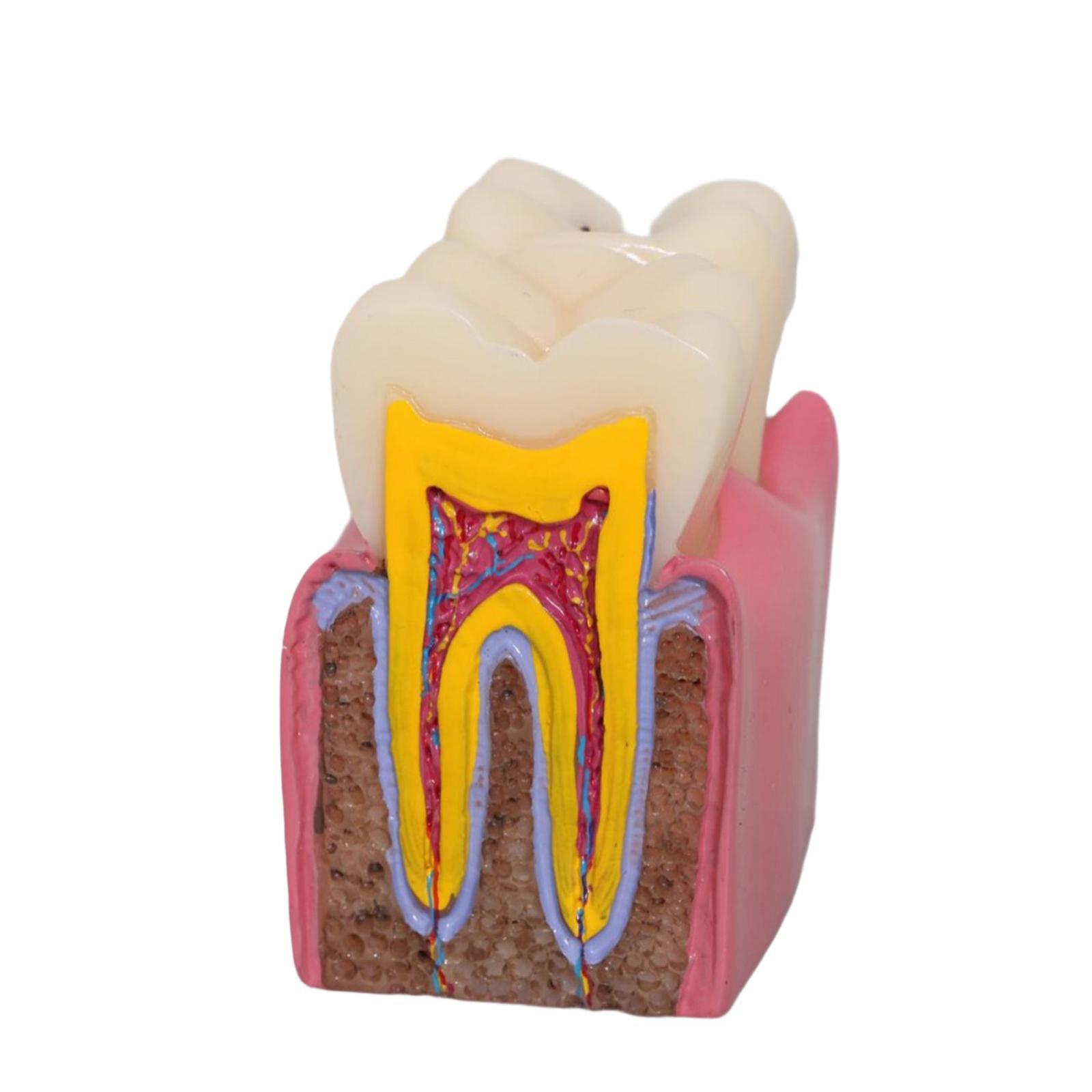 Tooth Decay Model Roots Canal  - Kids Education Classes ulasan dan harga